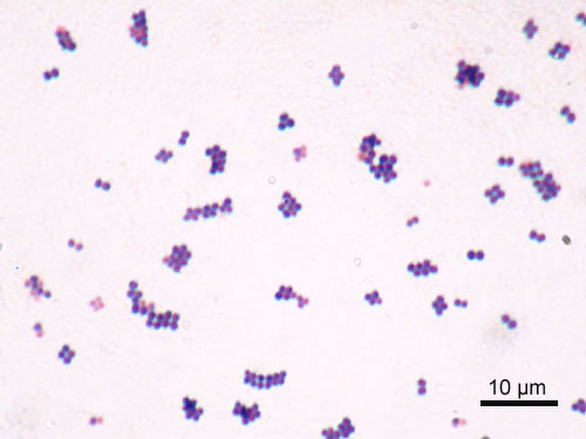 Photographie au microscope de bactéries Staphylococcus aureus