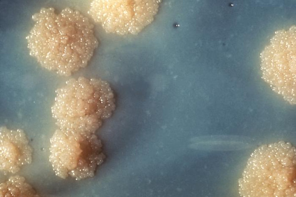 Mycobacteriaceae