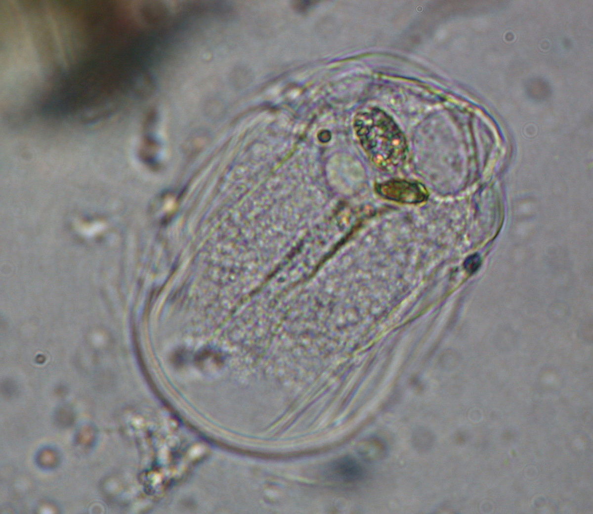 Amoebozoa (classification phylogénétique)