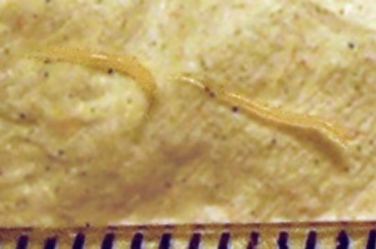Enterobius vermicularis