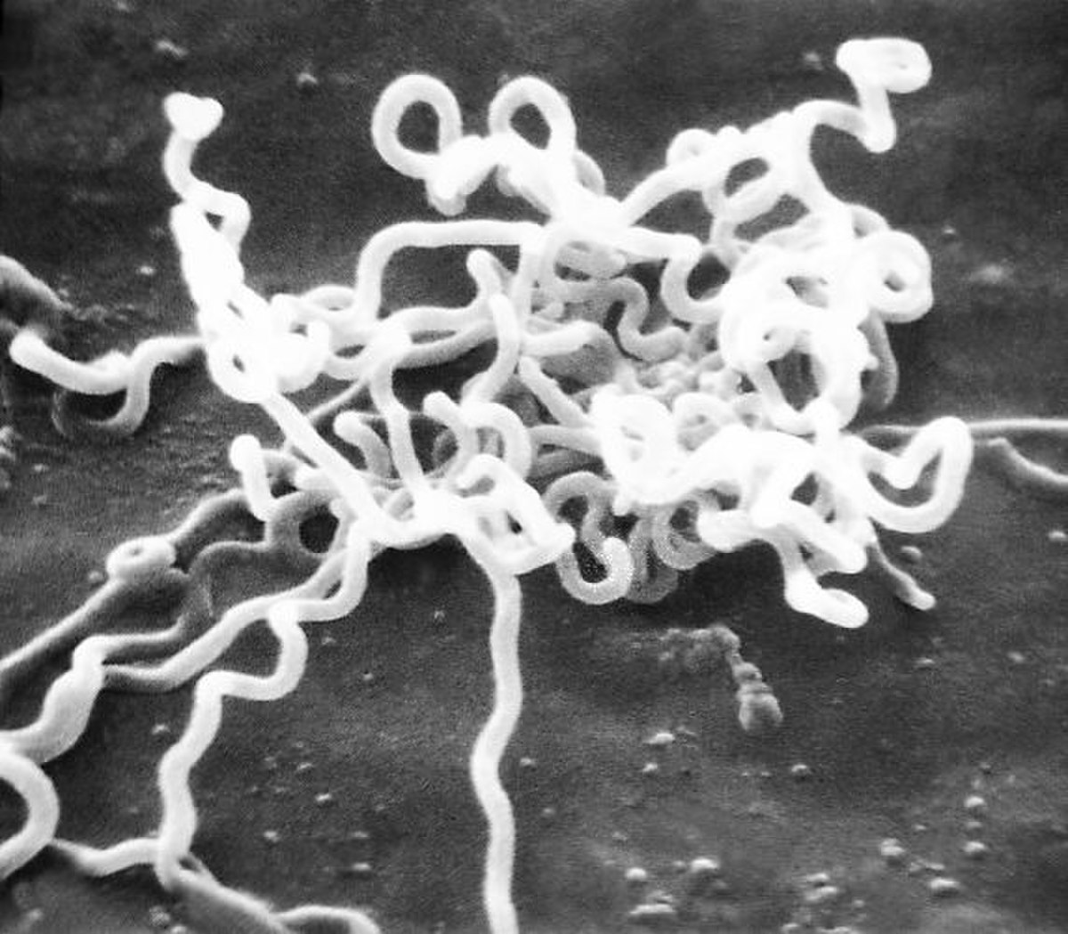 Spirochaetes