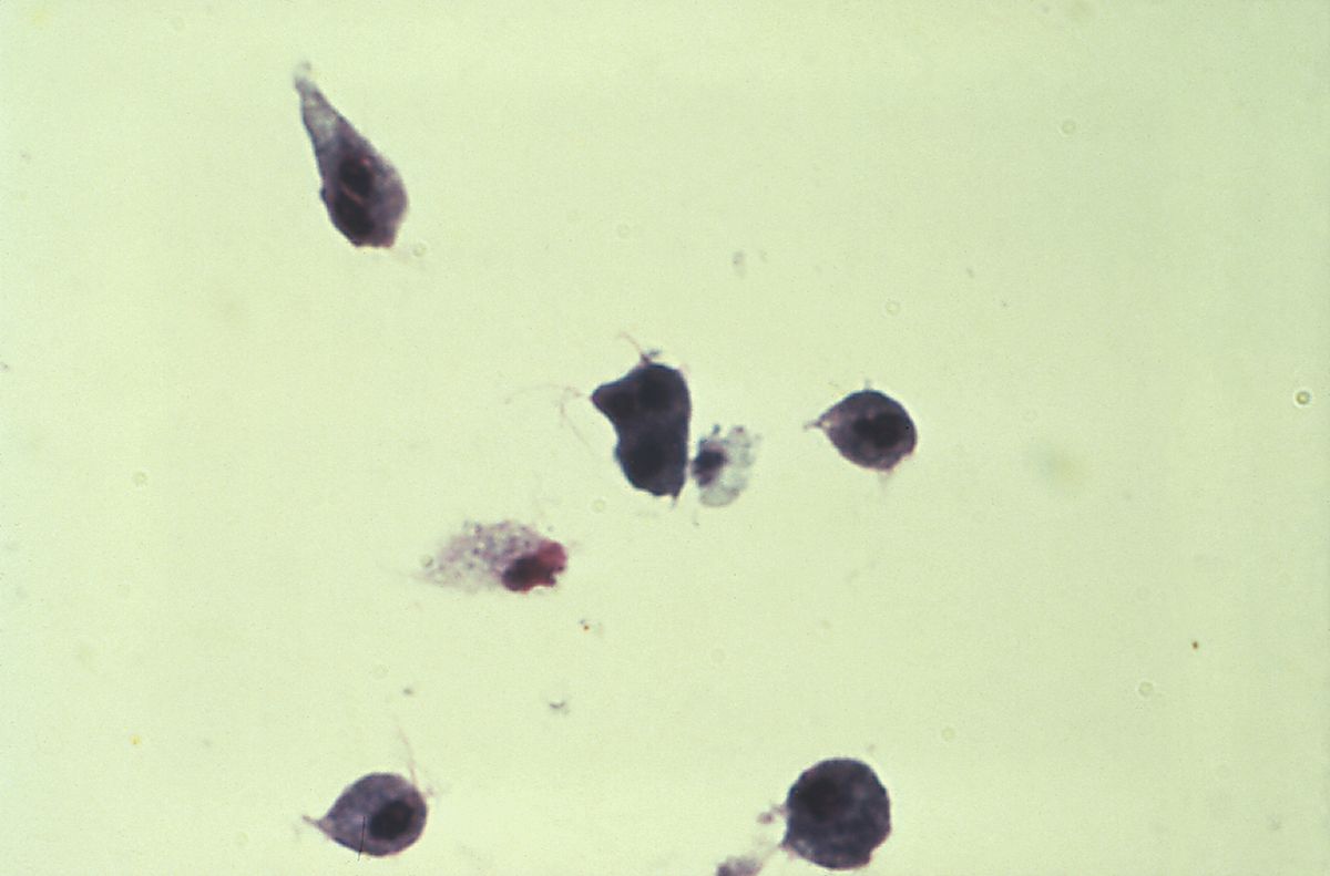 Trichomonas vaginalis