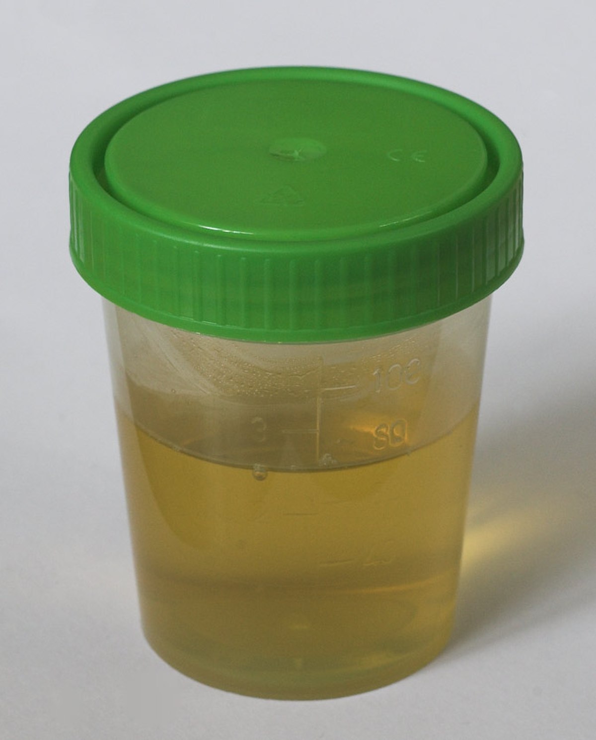 Urine