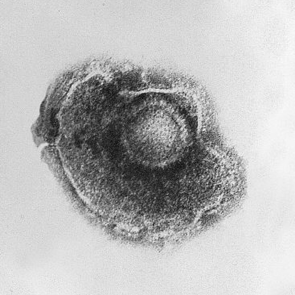 Virus varicelle-zona