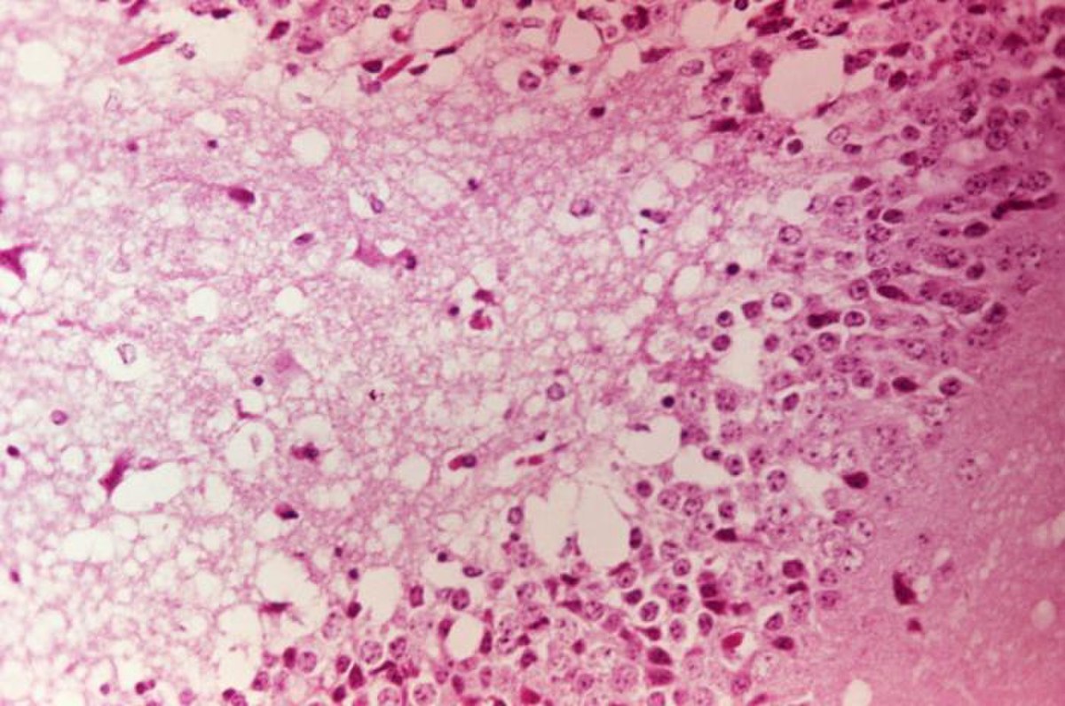 Virus de l'encéphalite équine vénézuelienne