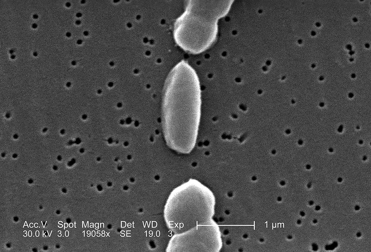 Vibrio parahaemolyticus