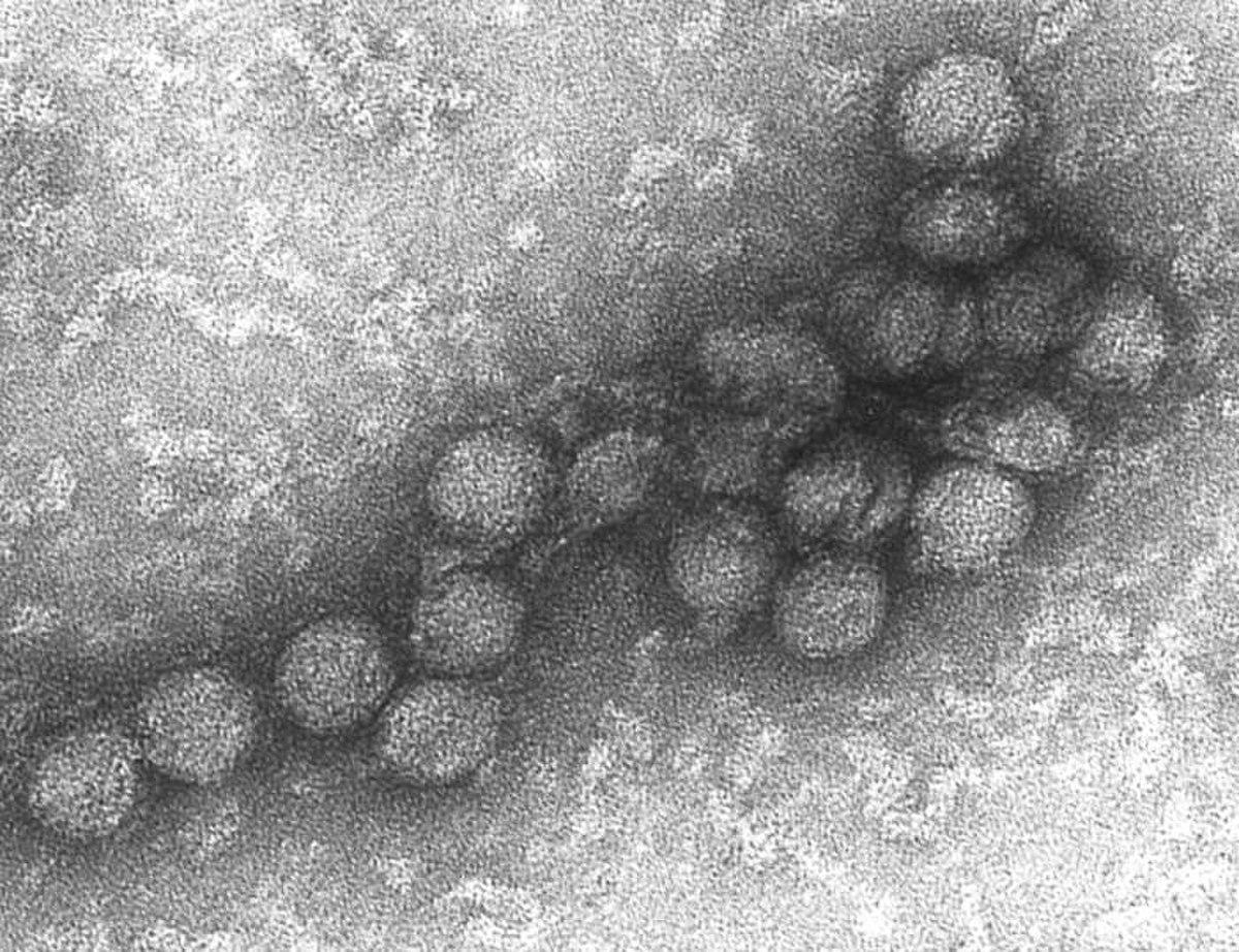 Virus du Nil occidental au microscope électronique