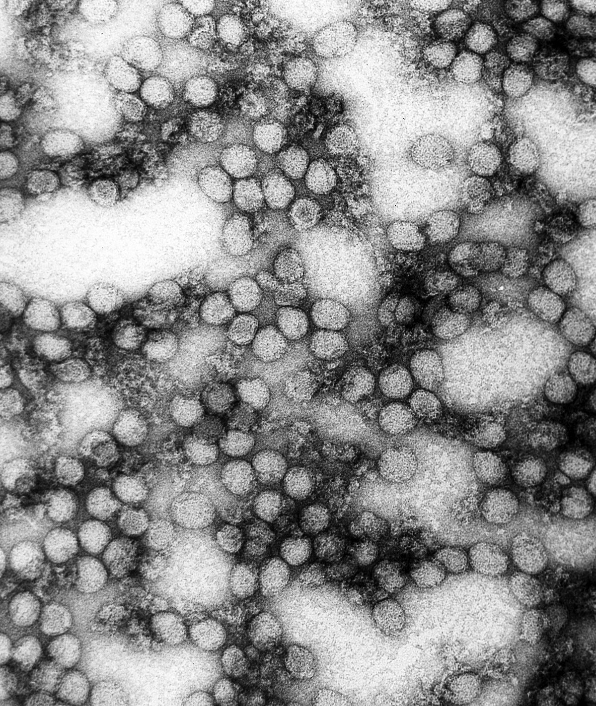 Virus de la fièvre jaune