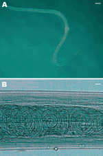 Thelazia callipaeda femelle