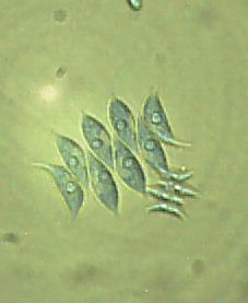 Scenedesmus acuminatus