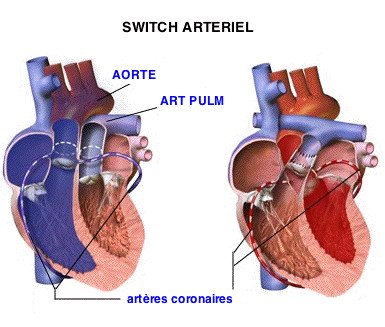 SwitchTGV-Wiki.jpg