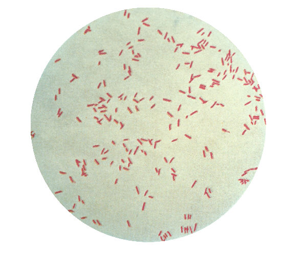 Pseudomonas aeruginosa en coloration de Gram