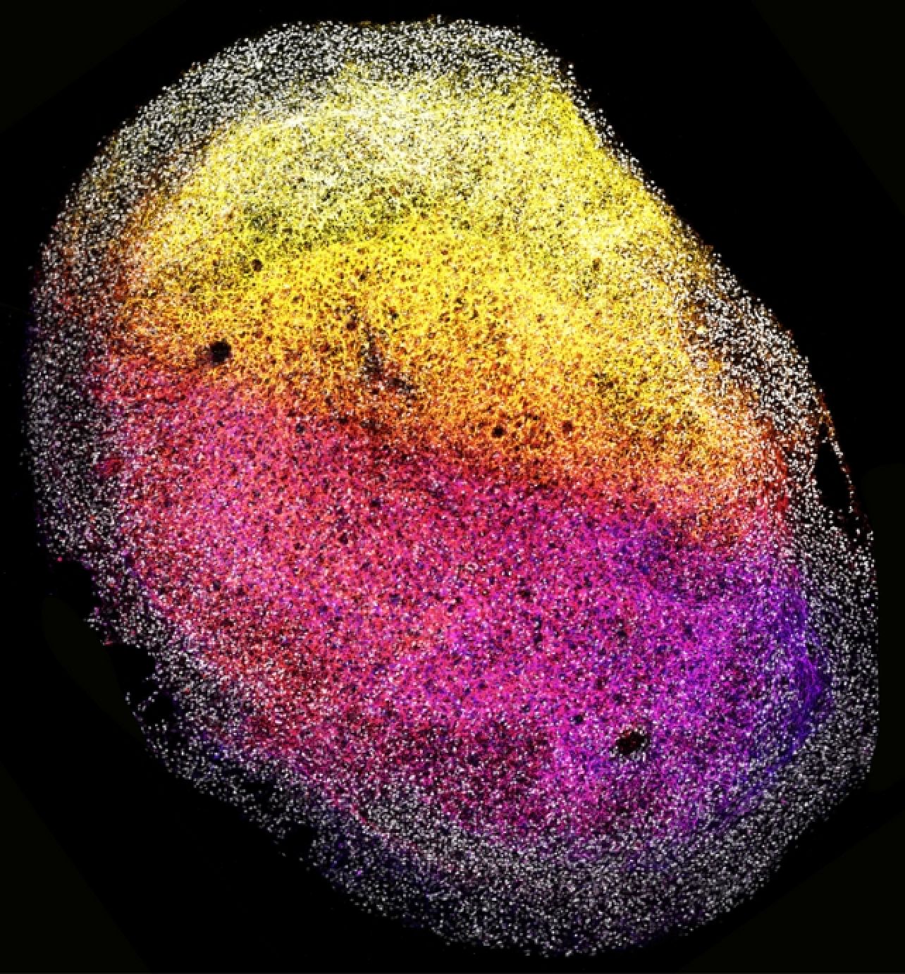 Des chercheurs ont développé ce mini-cerveau humain de la taille d'un grain de riz
