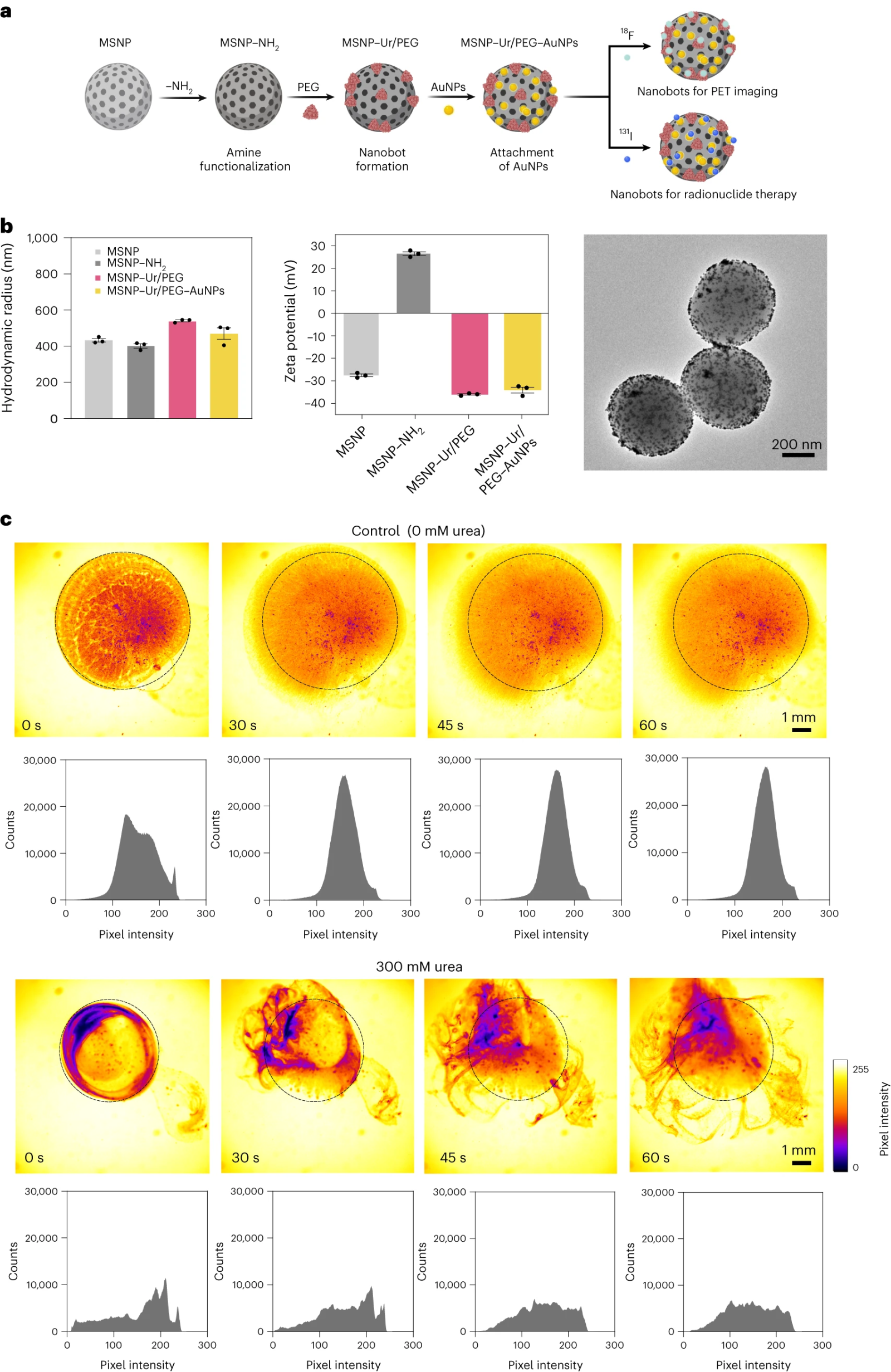 Ces nanorobots, alimentés par l'urine, réduisent de 90% les tumeurs de la vessie
