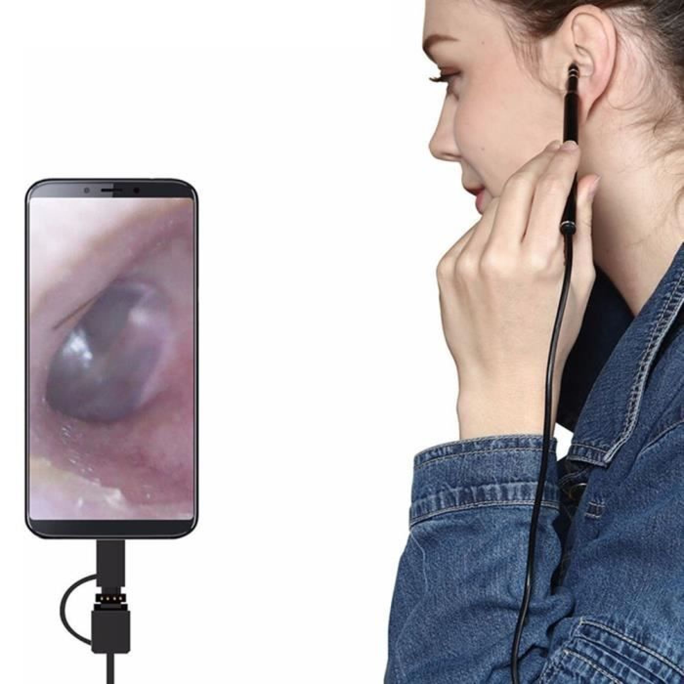 Esta aplicação para smartphone usa IA para detectar otites