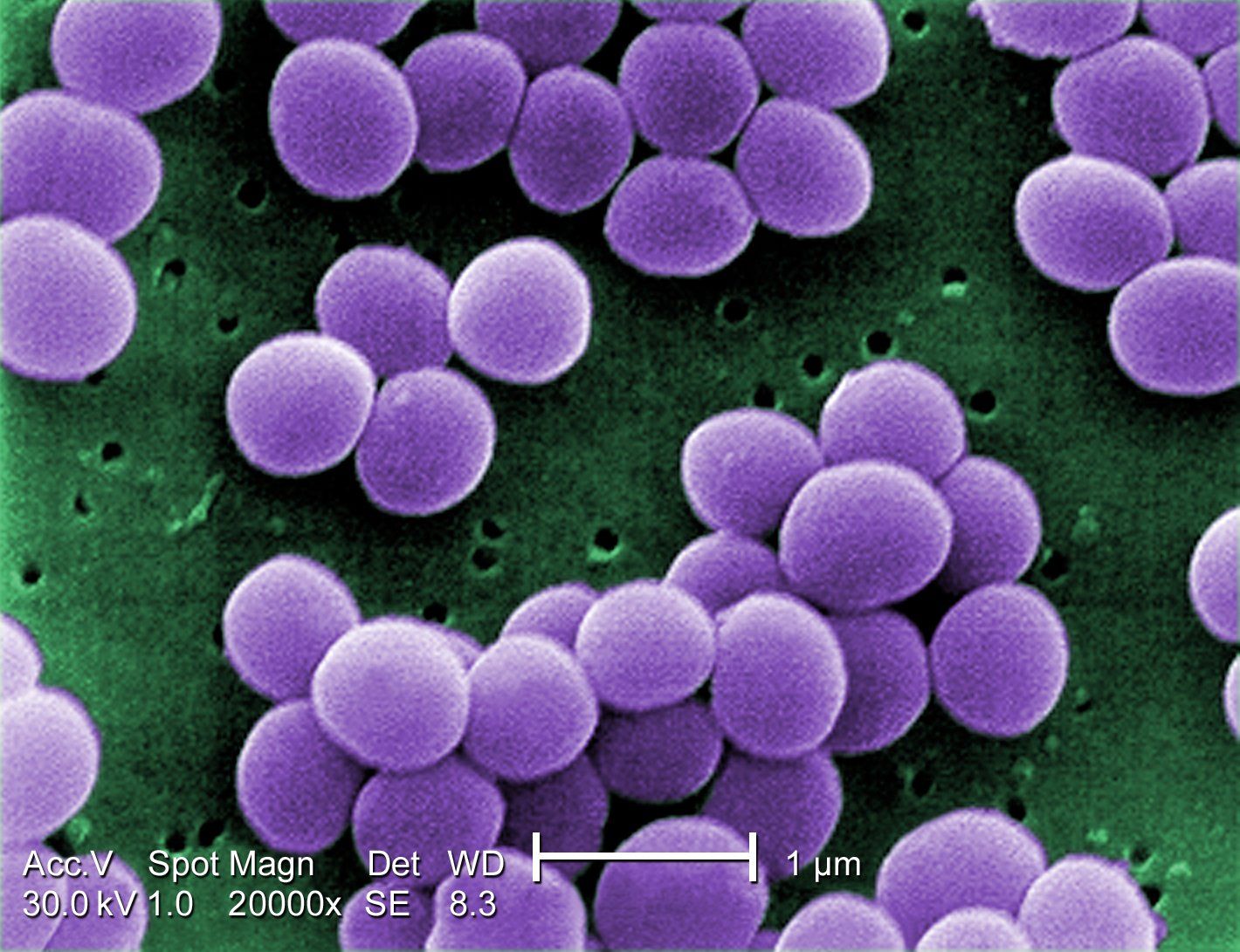 AI reveals a new antibiotic capable of destroying multi-drug resistant staphylococcus aureus