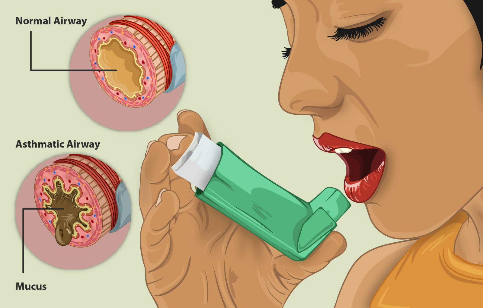Major breakthrough in respiratory allergies