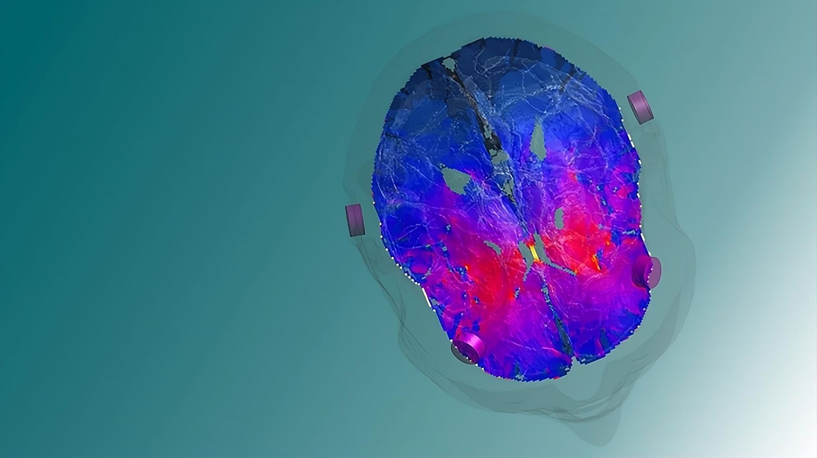 Esta estimulação cerebral não invasiva pode tratar a depressão, os vícios e os TOC