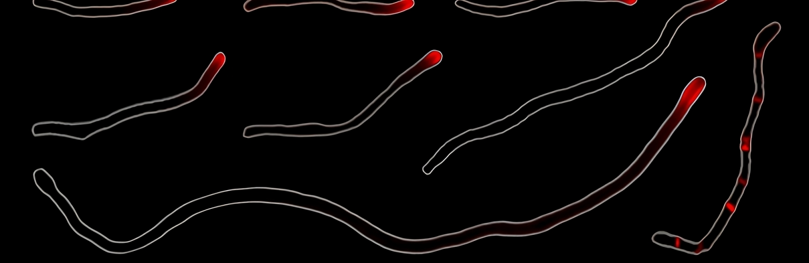 Vidéo: la stratégie inédite de bactéries buccales pour coloniser votre bouche