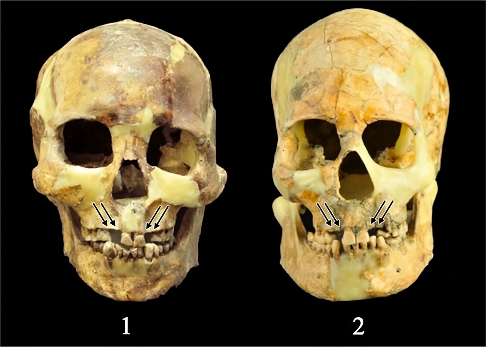But why did ancient Taiwanese people pull out their healthy teeth?