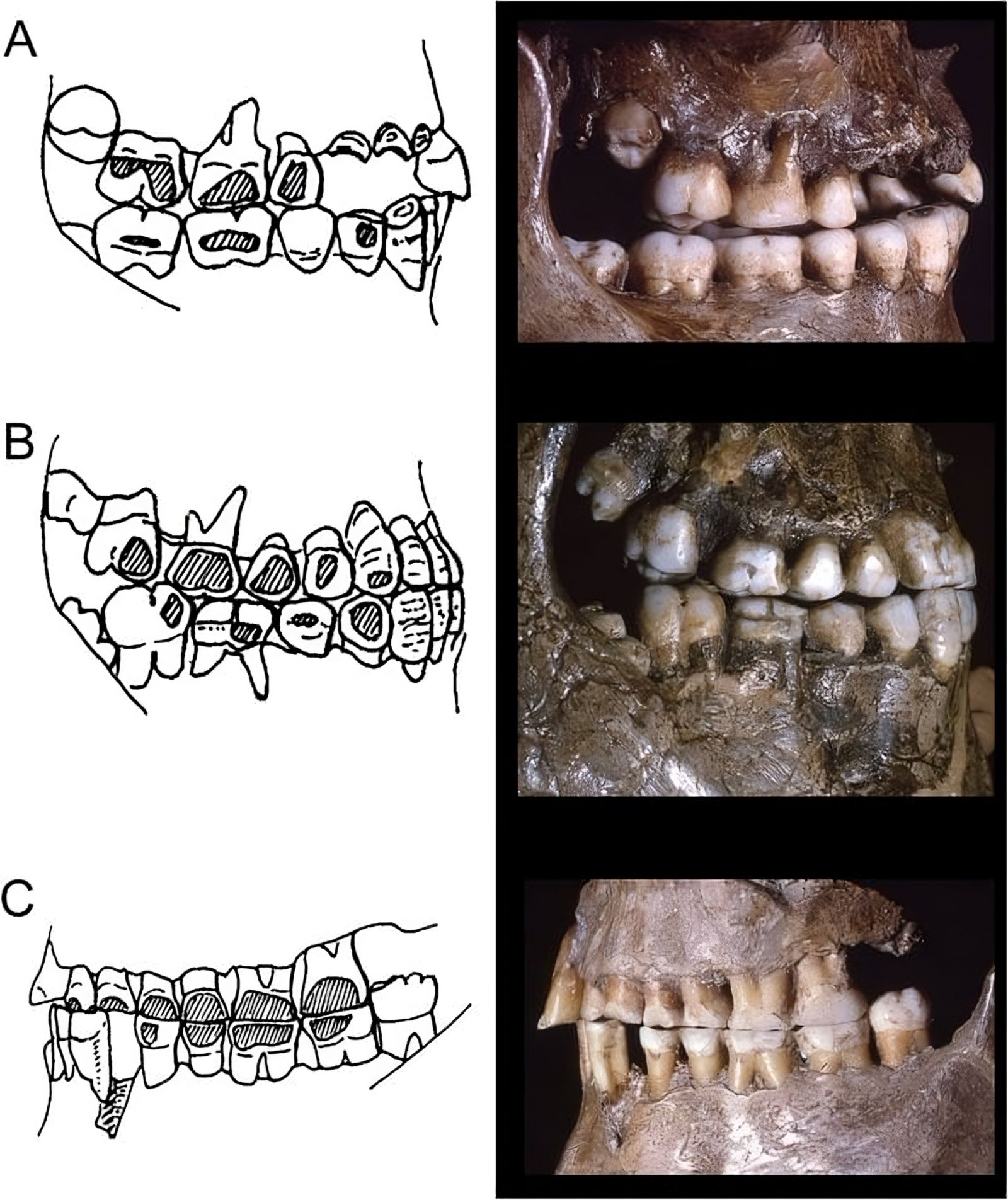 Há 30 mil anos, esses europeus usavam piercings nas bochechas 🔍