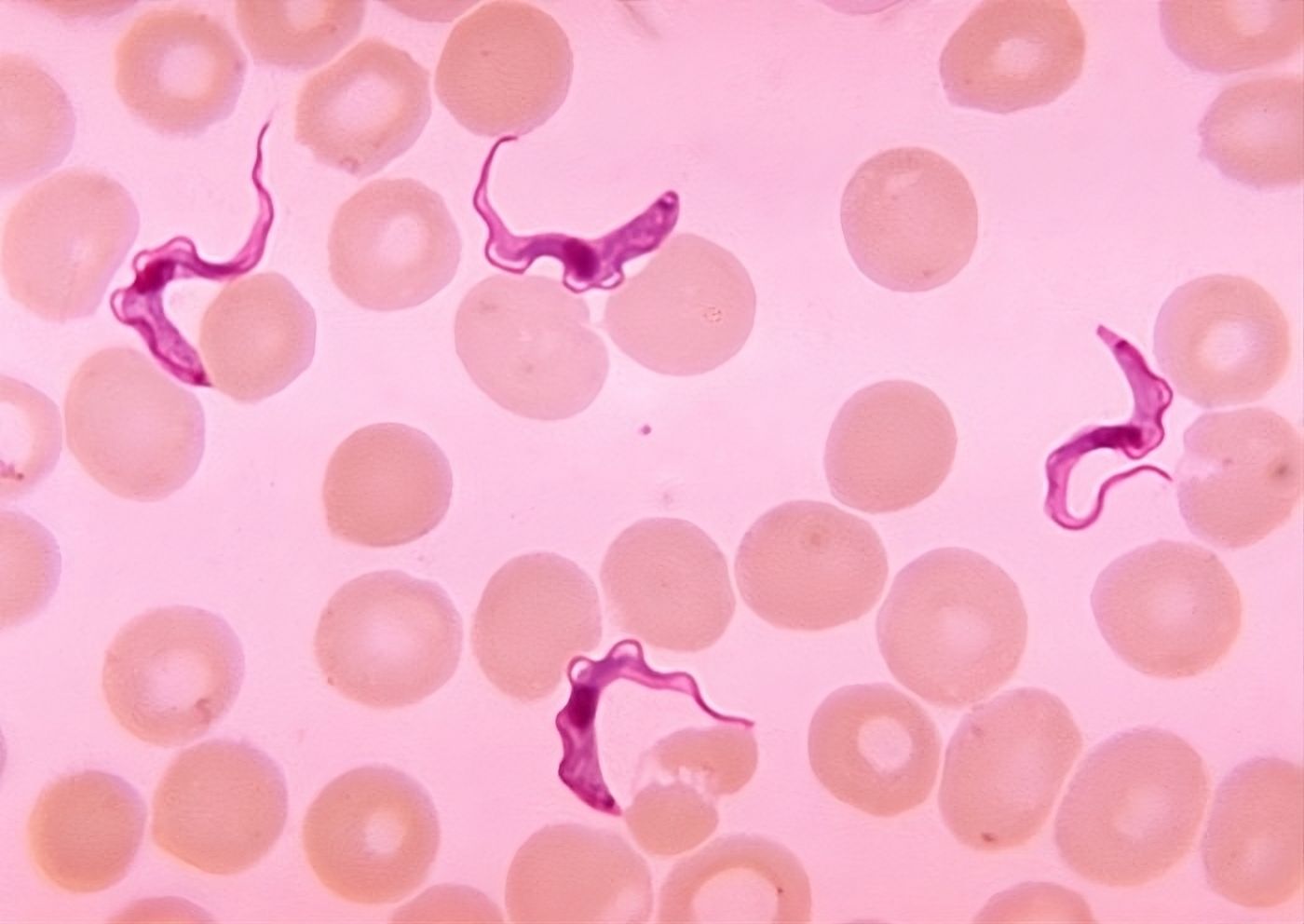 Discovery of a vector for sleeping sickness 💤