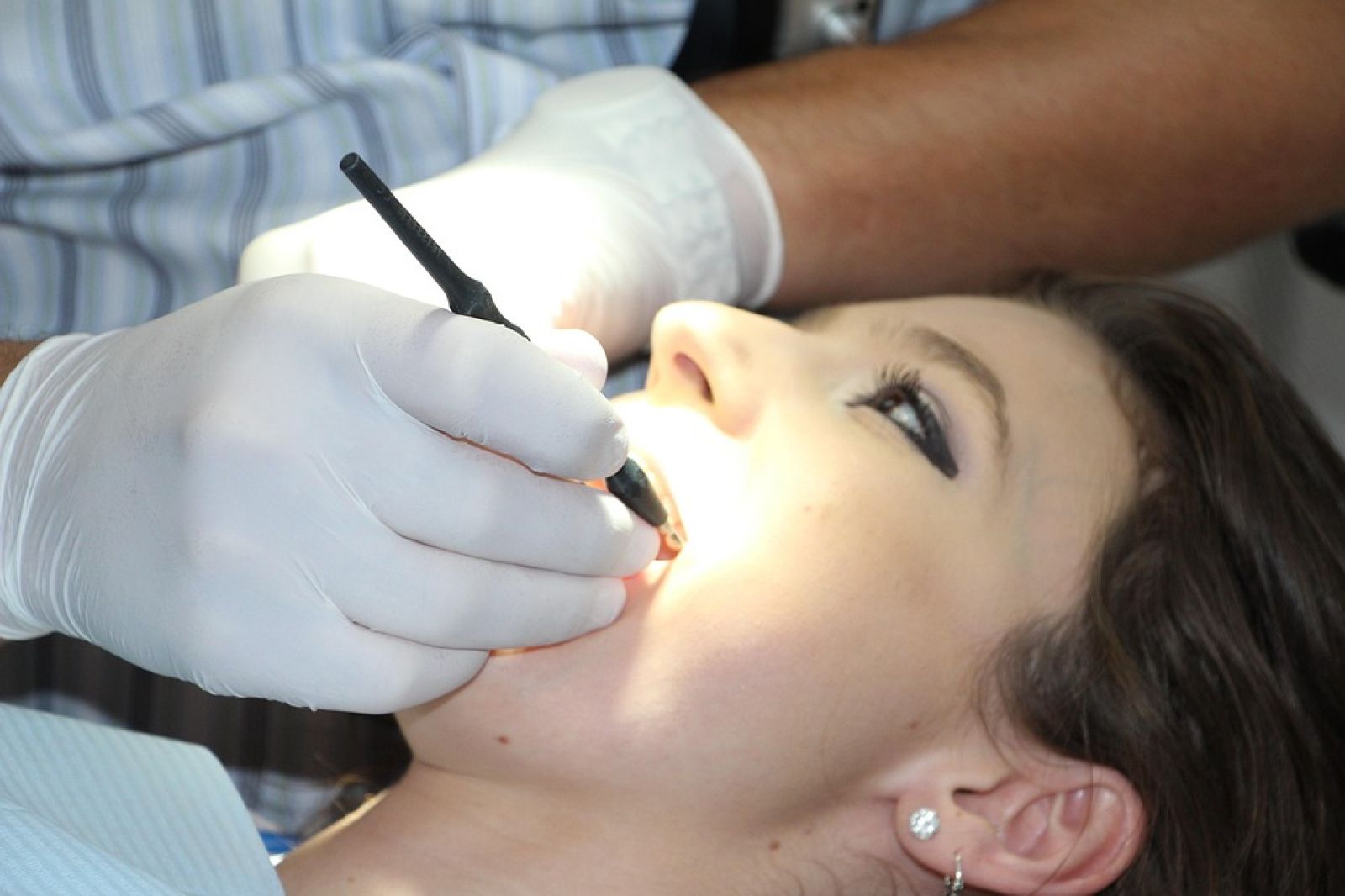 🦷 Fim das cáries? Um gel faz o esmalte dos dentes crescer naturalmente