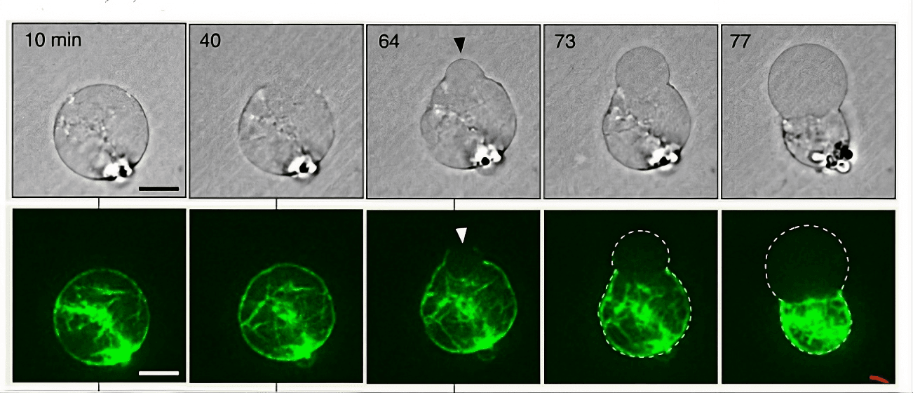 🫧 Des cellules artificielles montrent comment une membrane peut former une énorme bulle