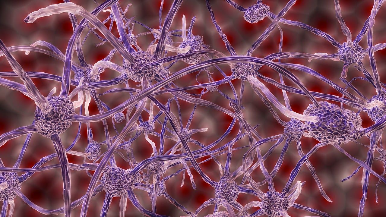 Alzheimer: when a neural conductor loses its rhythm