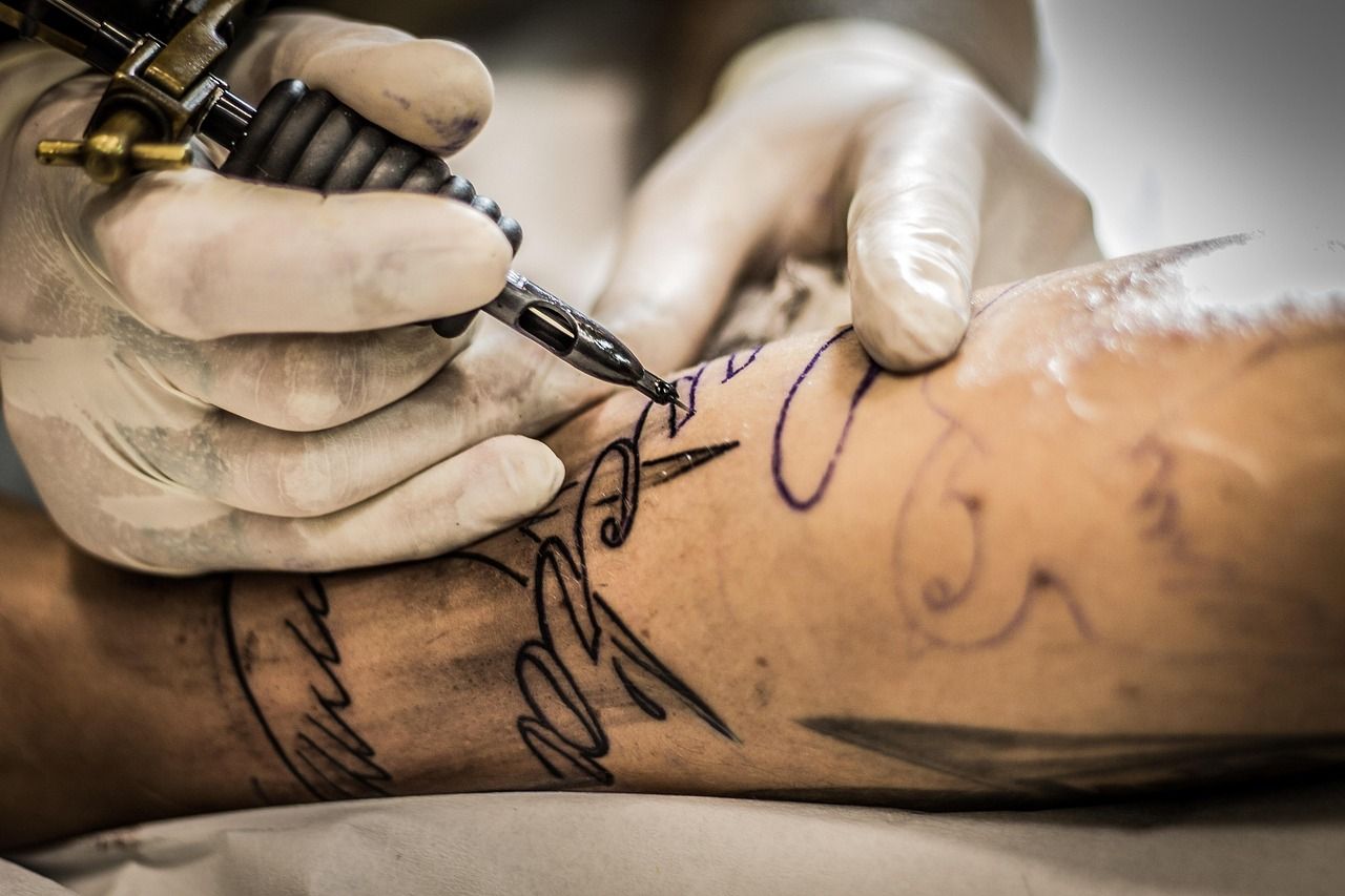 Détatouage laser : une solution moderne pour effacer un tatouage