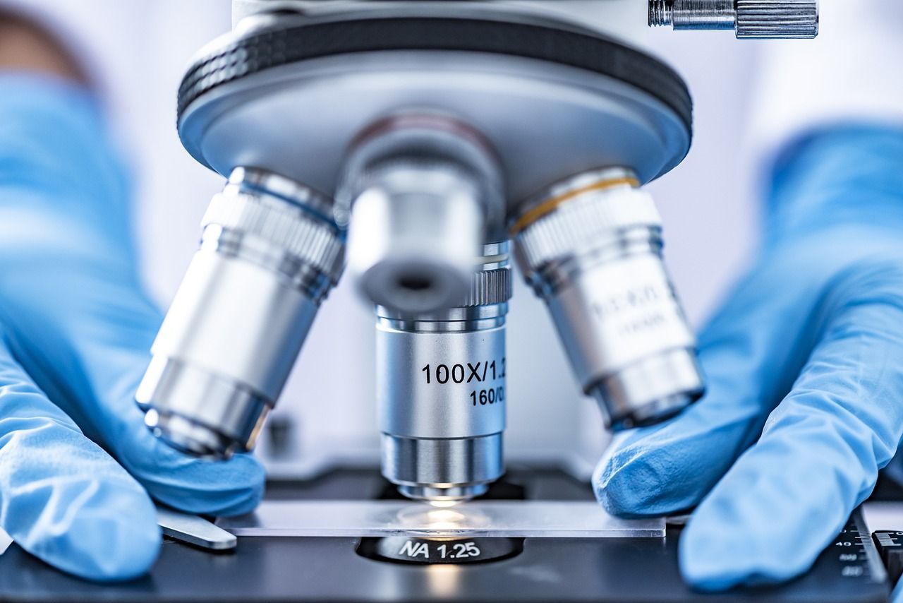 Cancer du pancréas: vers un traitement efficace bloquant la molécule responsable