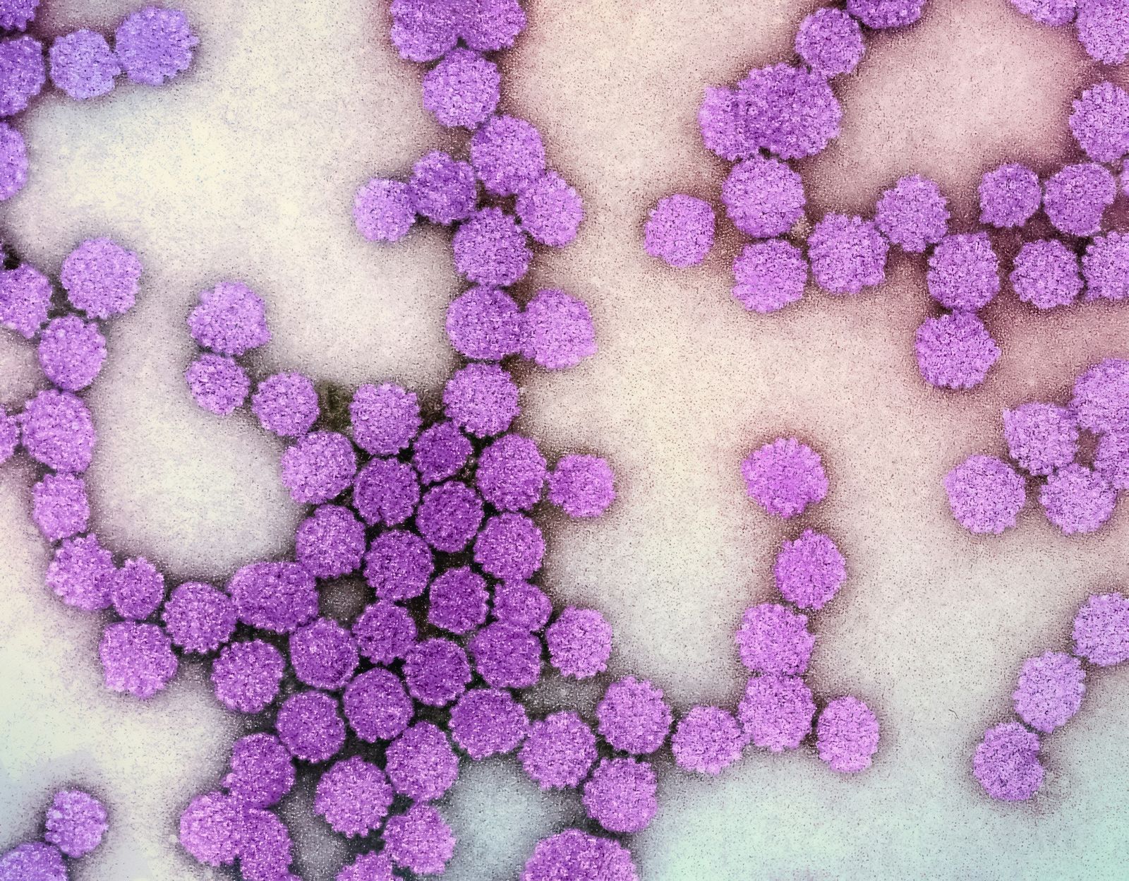 Papillomavirus humain observé en microscopie électronique et colorisé.