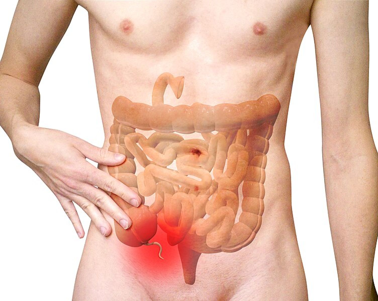 Apendicite: cirurgia ou antibióticos? ⚕️