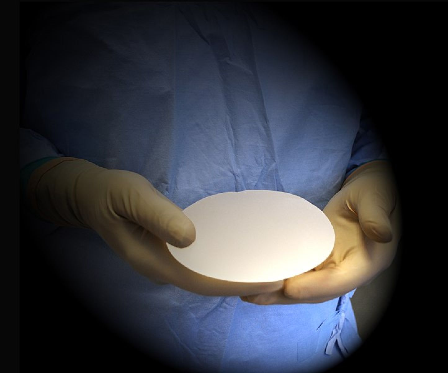 Implantes mamários de silicone: uma toxicidade questionada