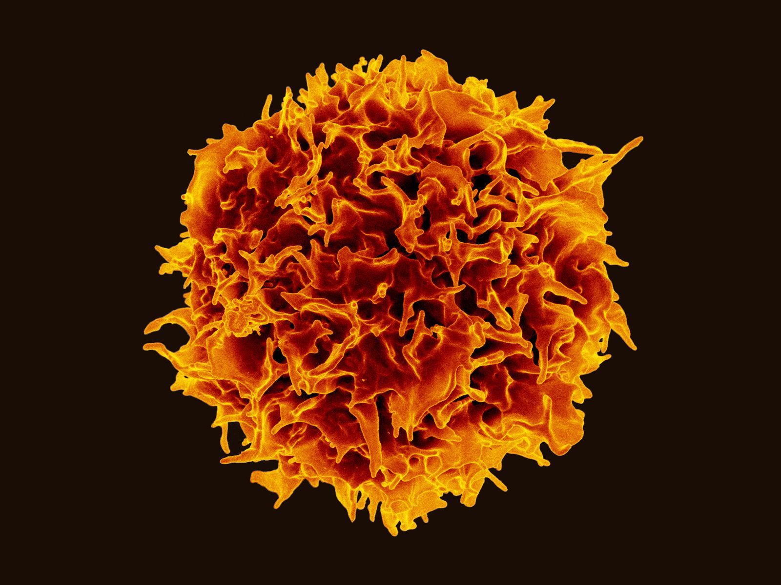 Un lymphocyte T observé au microscope électronique à balayage et colorisé.