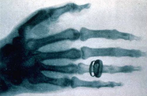 20 fois moins de rayons X lors d'une radiographie