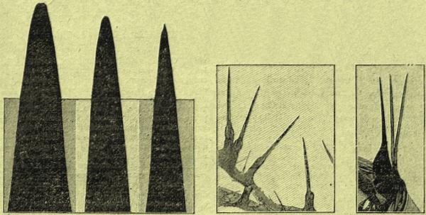 Rétro 1905 : Les révélations du microscope