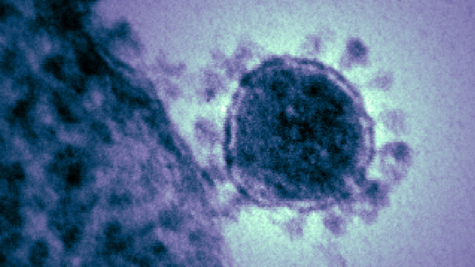 Il y a un an, le premier génome d’un nouveau coronavirus