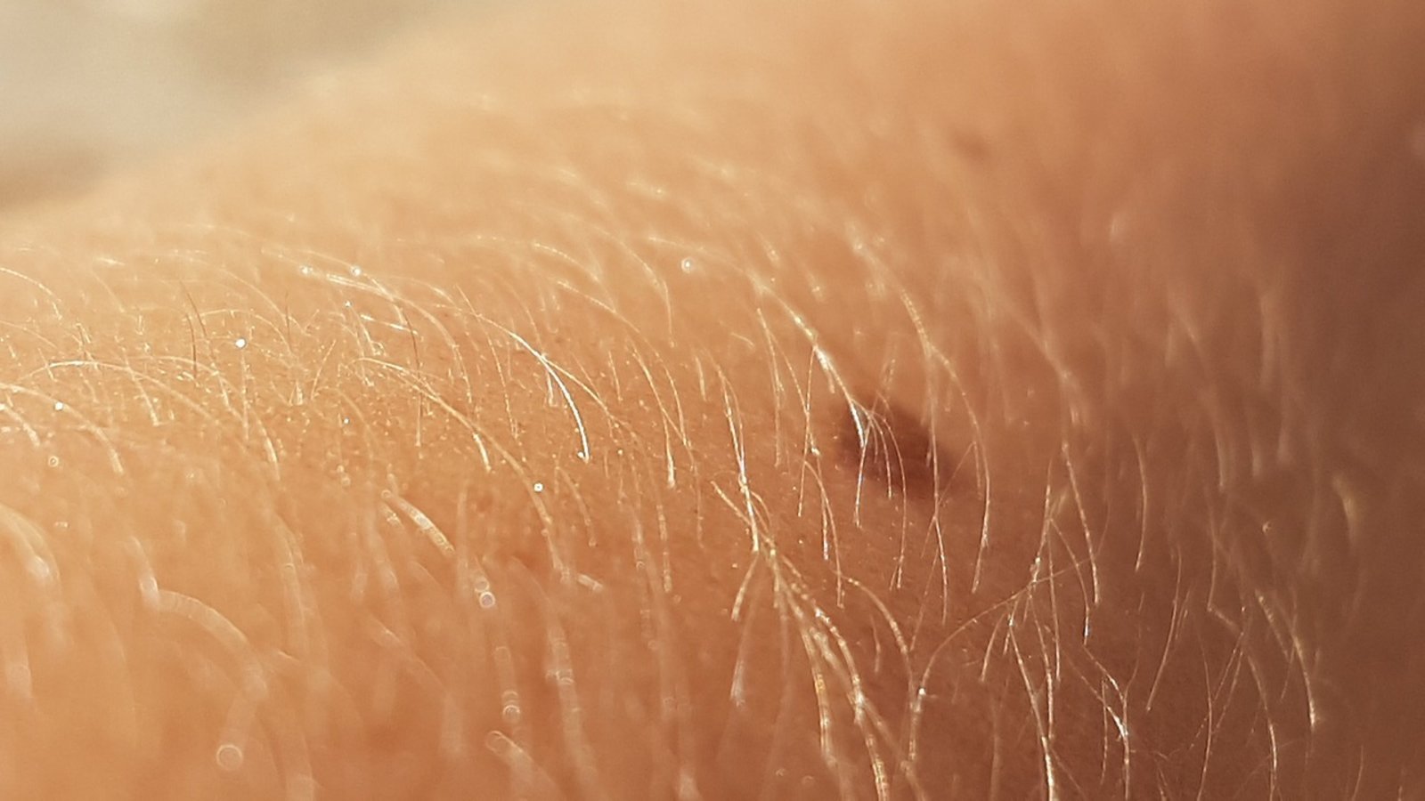L’être humain a-t-il encore besoin de poils ?
