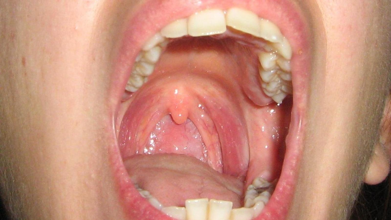 Même à faibles doses, l’exposition au perturbateur endocrinien DEHP altère le développement des dents