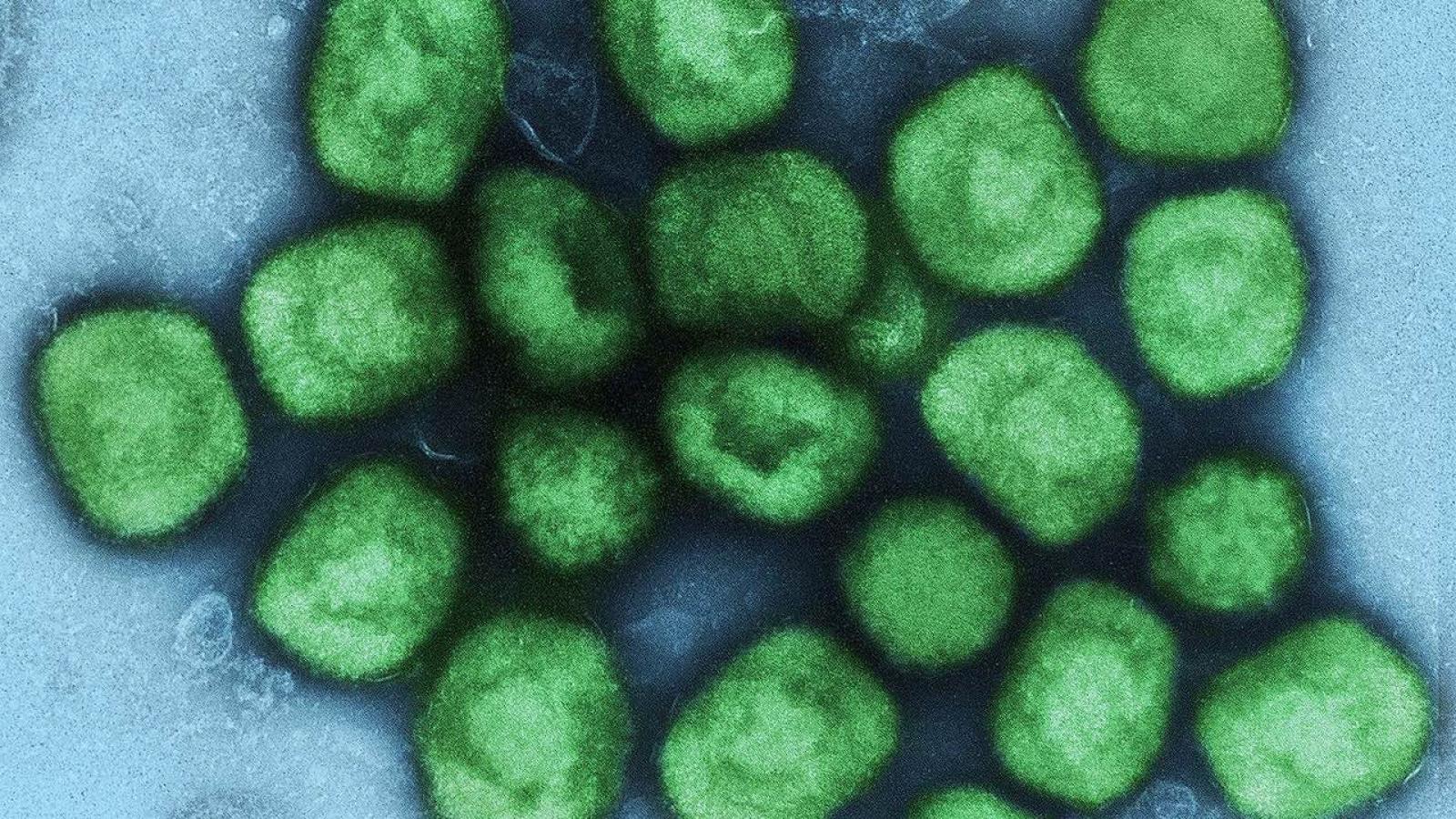 Variole du singe et vaccination en anneau