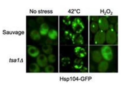 Le stress oxydant augmente le vieillissement cellulaire