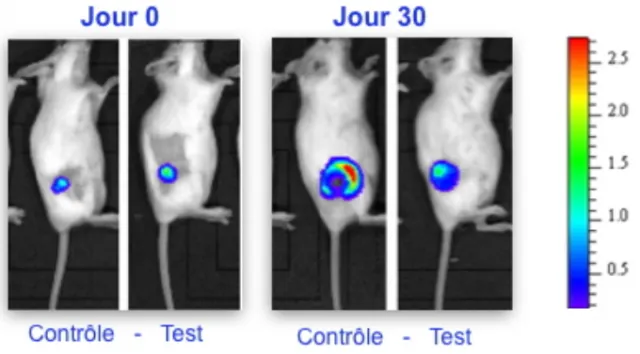 Stratégie multi-cibles pour lutter contre la progression tumorale