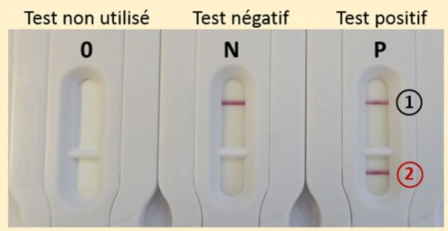 Détecter l’antibiorésistance plus vite et plus simplement