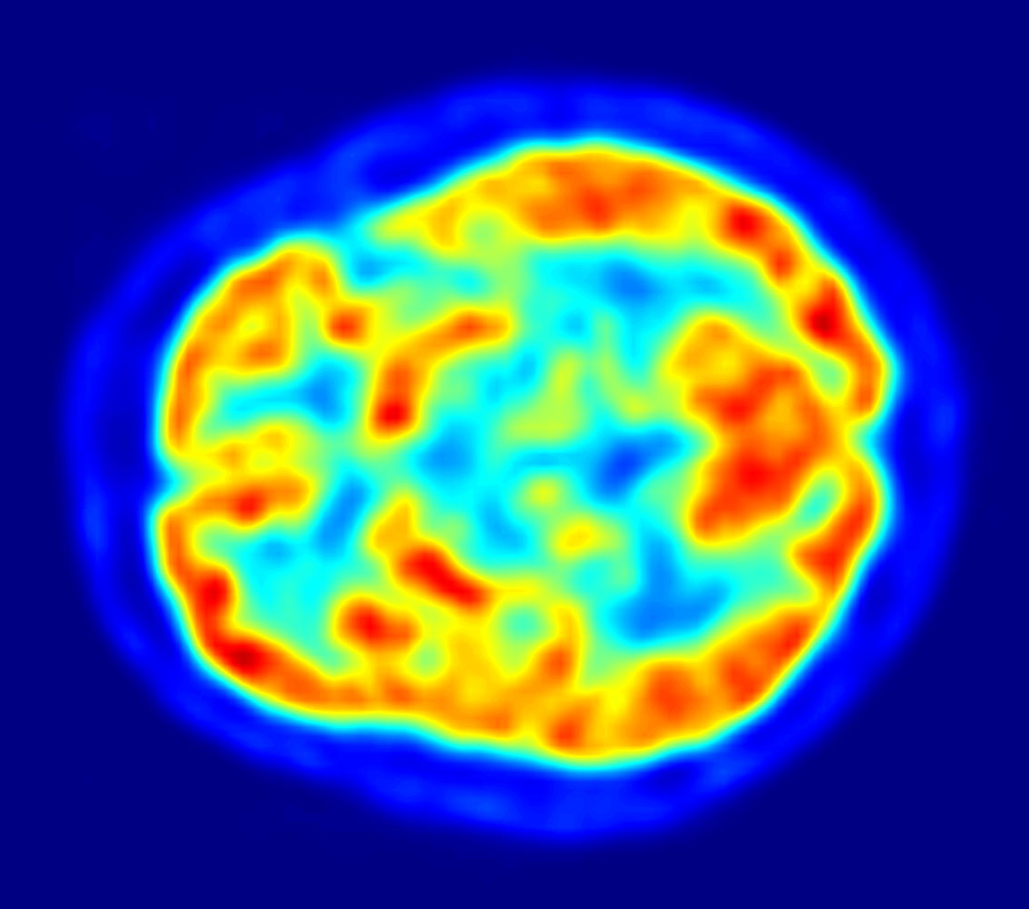 La physique dans les profondeurs du cerveau