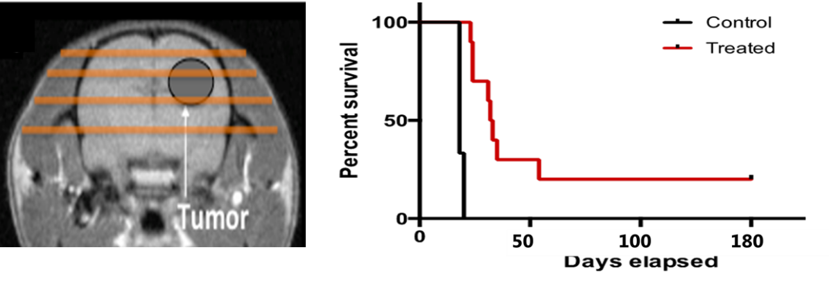 Soigner des cancers avec des minifaisceaux de protons