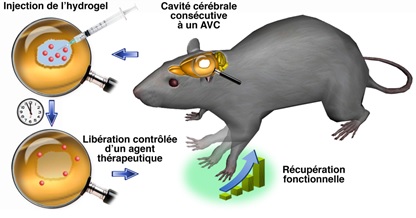 Un hydrogel injectable et dégradable pour réparer le cerveau