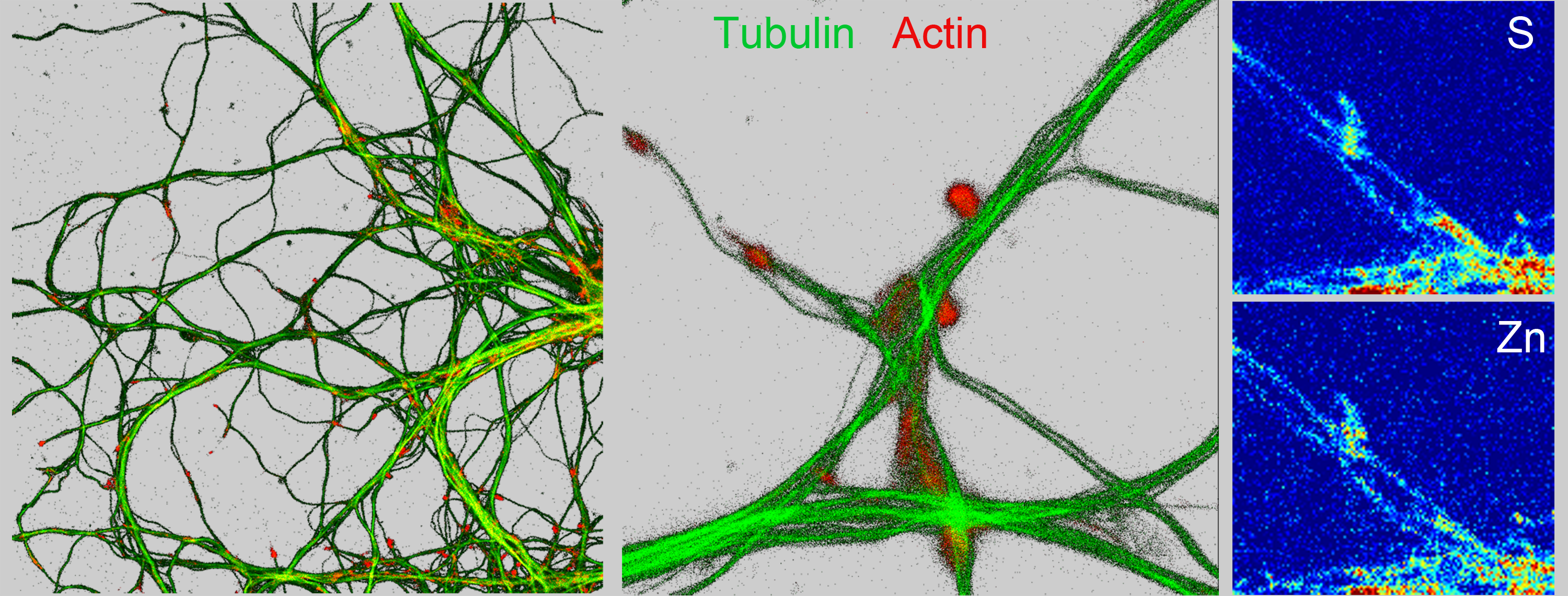 Imagerie inédite de jonctions entre neurones