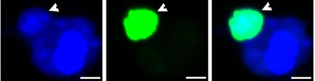 Découverte d'une symbiose algue-cyanobactérie