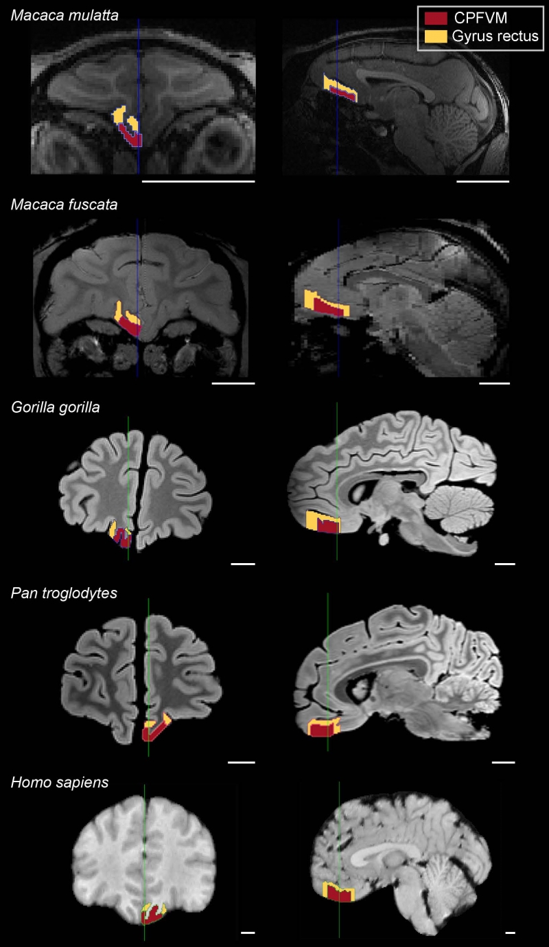 "Je mange donc je suis": le cerveau des primates, reflet de leur alimentation